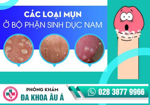Nguyên nhân gây mụn ở dương vật