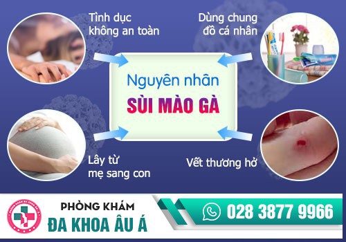 Nguyên nhân gây bệnh sùi mào gà là gì?